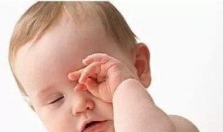 新生儿健康 新生儿健康